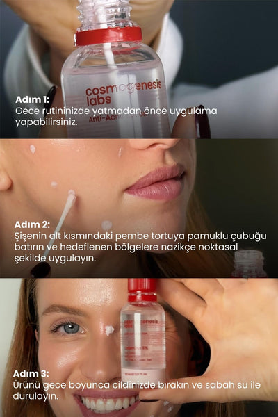 Cosmogenesis Labs Acne Önleyici Kurutucu Losyon 30ml – Yatıştırıcı Siyah Nokta Azaltıcı Vegan