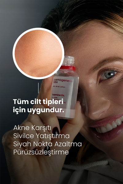 Cosmogenesis Labs Acne Önleyici Kurutucu Losyon 30ml – Yatıştırıcı Siyah Nokta Azaltıcı Vegan