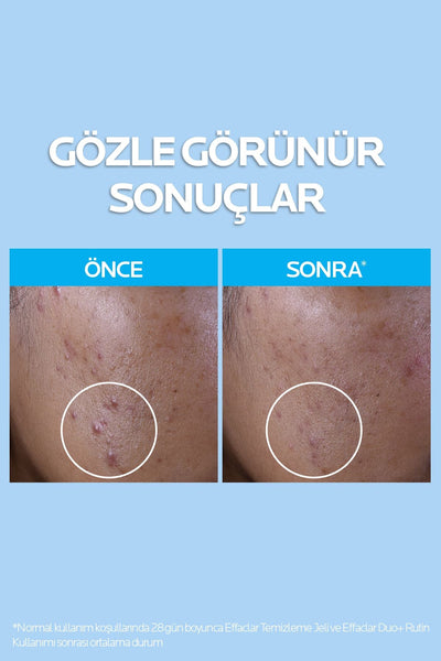 La Roche Posay Effaclar Yağlı Ve Akneye Eğilimli Ciltler için Yüz Temizleme Jeli 400 ml