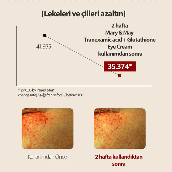 Mary & May Tranexamic Acid+Glutathion Koyu Halka Karşıtı Aydınlatıcı Göz Çevresi Kremi 12 Gr