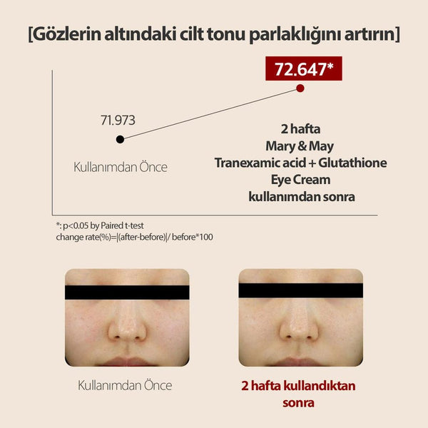 Mary & May Tranexamic Acid+Glutathion Koyu Halka Karşıtı Aydınlatıcı Göz Çevresi Kremi 12 Gr