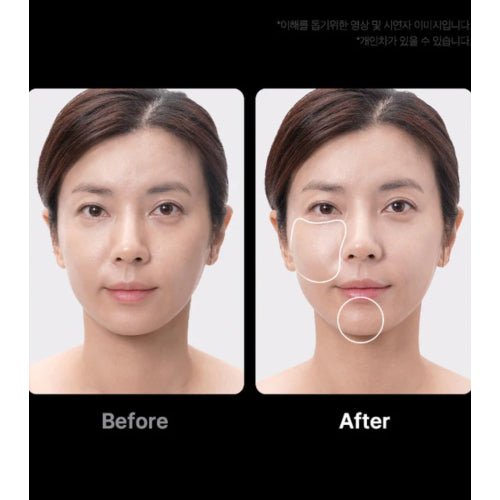 Medicube - AGE-R Booster Pro (4 Farklı Modlu Kore Cam Cilt Bakım Cihazı) Pembe
